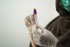 ワキガ治療におけるミラドライの医療ローン利用は可否？