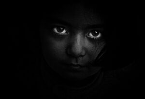 ミラドライのワキガ効果は1回目と2回目でどう違うのか？
