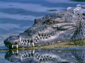 腋臭症のミラドライ治療後、再発不安が残る人はどう対処すべき？